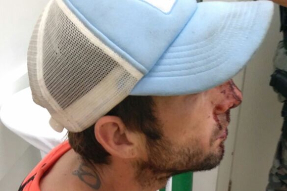 Homem foi atendido no Hospital Santa Cruz com lesão na face
