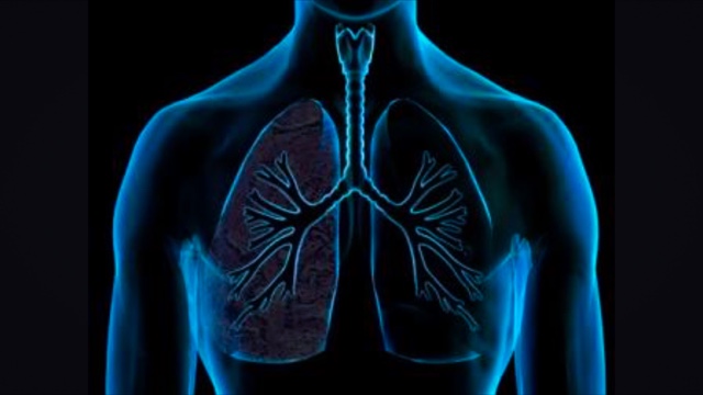 Doença afeta principalmente os pulmões