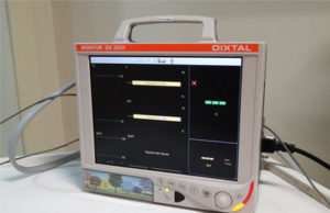 Hospital Ana Nery recebe novos equipamentos