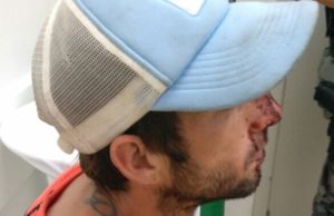 Populares agridem assaltante em Santa Cruz