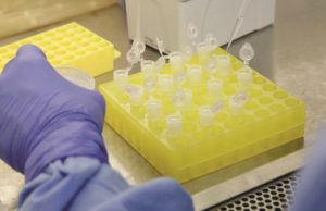 Coronavírus é descartado em paciente santa-cruzense