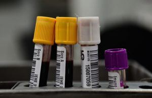 Hemorio inicia testes com plasma sanguíneo no tratamento de covid-19