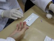 Acadêmicos da Unisc realizarão testes rápidos para Covid-19 em residências do município
