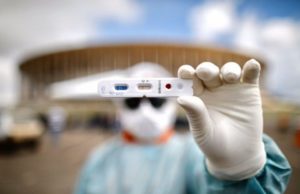 Anvisa aprova testes rápidos para covid-19 em farmácias