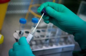 Santa Cruz tem 21 casos suspeitos de Covid-19