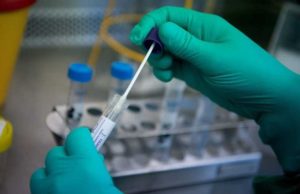 Morador de Bento Gonçalves transferido para o Hospital Santa Cruz testa positivo para Covid-19