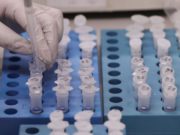 Em 16 dias, 58 pessoas foram testadas para Covid-19 pela Unisc