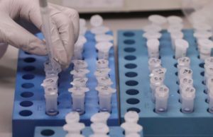 Em 16 dias, 58 pessoas foram testadas para Covid-19 pela Unisc