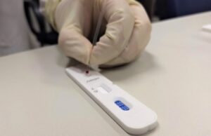 Entenda a diferença entre teste rápido e a PCR