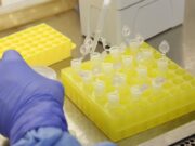Testes para vacina contra HIV têm resultados promissores