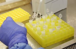 Testes para vacina contra HIV têm resultados promissores