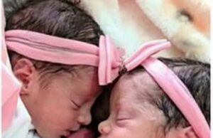 Recém-nascidas gêmeas morrem após serem atacadas por cachorro da família na Bahia
