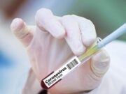 Covid-19: Brasil ingressa em consórcio global para produzir vacina