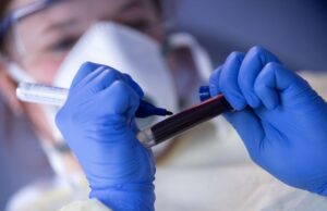 ANS retira teste para covid-19 de lista obrigatória de cobertura
