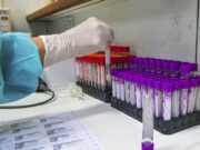 Covid-19 tem mais de 30 milhões de casos em todo o mundo