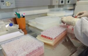 Covid-19: Central regional de triagem em Santa Cruz já testou 846 pessoas