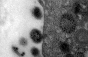 Covid-19: anticorpos podem durar até 12 meses após infecção